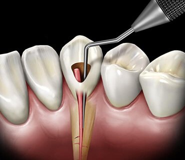 Denta Peak Diş Kliniği